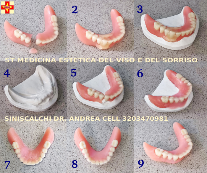 Costo Di Riparazione Del Pavimento Scoppiato | Resin Pro - Foto 7